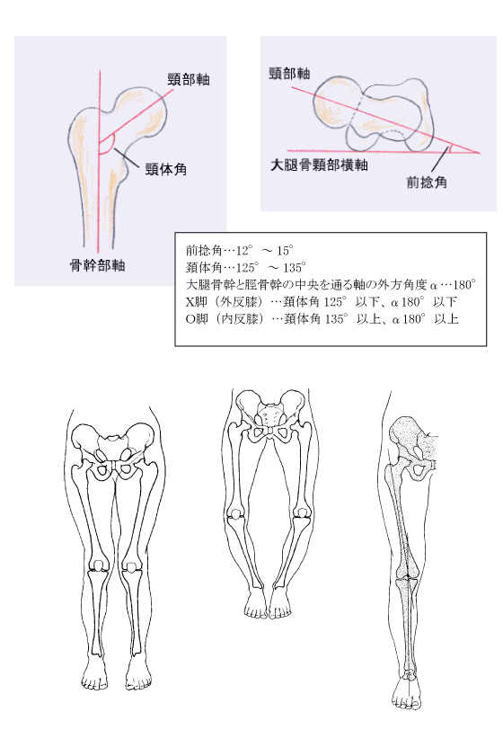 骨の異常によるO脚・X脚