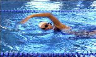 インピンジメント症候群